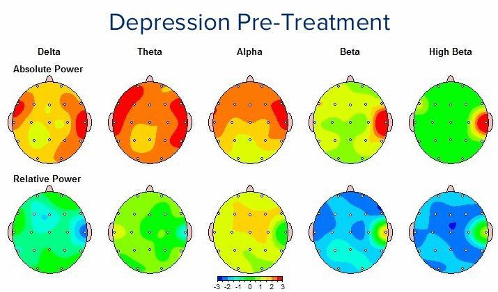 depresyonun tedavi nedir
